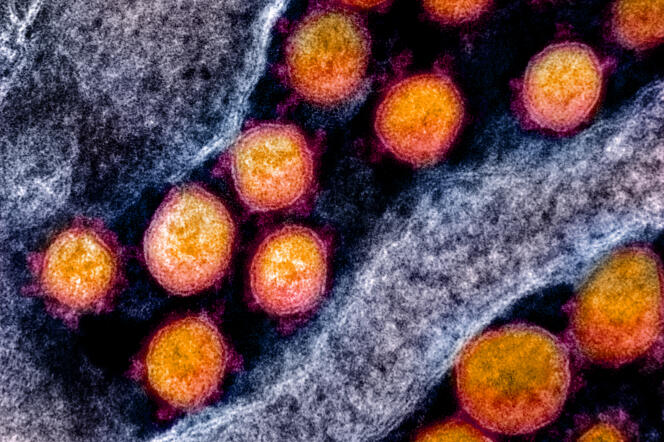 SARS-CoV-2 virions photographed using a transmission electron microscope and recolored.