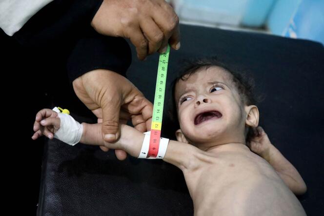 Un enfant reçoit des soins dans un centre de traitement de la malnutrition, à Taëz, au Yémen, le 6 mars 2022.