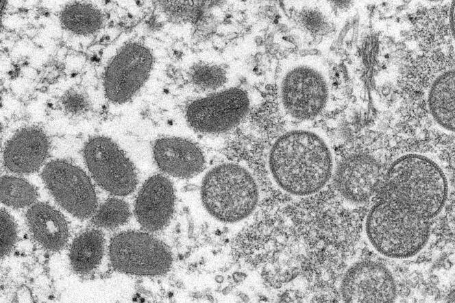 Image au microscope électronique de 2003 montrant des virions de variole du singe matures, de forme ovale, à gauche, et des virions immatures sphériques, à droite, obtenus à partir d’un échantillon de peau humaine.