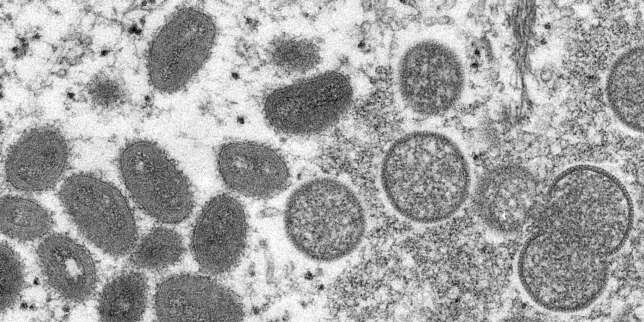 De nouveaux cas de variole du singe détectés quotidiennement au Royaume-Uni