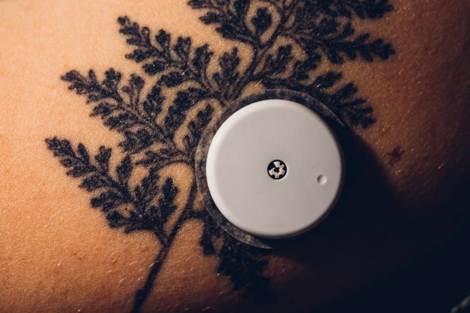 In Paris, in March 2020, a patient with type 1 diabetes uses a self-glucose monitoring system with a FreeStyle Libre 2 sensor.