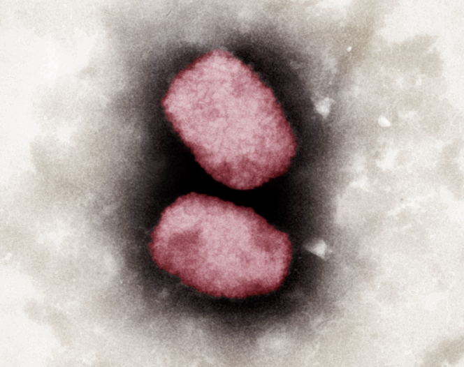 Photographie colorisée du virus de la variole du singe par microscope électronique prise en 2001 et transmise par l’Institut Robert Koch (Allemagne).