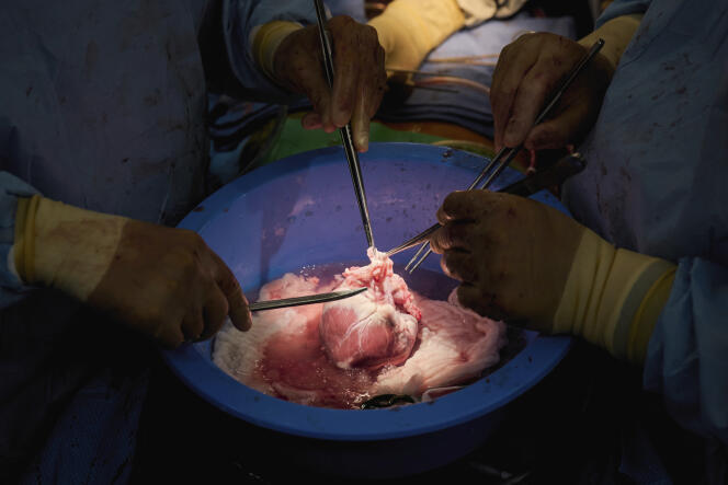 Des chirurgiens préparent un cœur de porc génétiquement modifié pour une greffe sur une personne récemment décédée, au centre médical de l’école de médecine NYU Langone Health, à New York, le 6 juillet 2022. 