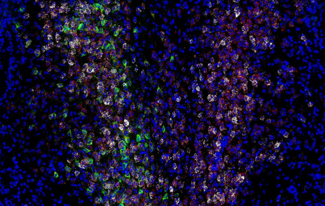 Expression de divers gènes et protéines (blanc, rouge et vert) dans les neurones parmi les cellules du cerveau de la souris (bleu).