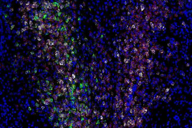 Expression of various genes and proteins (white, red and green) in neurons among mouse brain cells (blue)