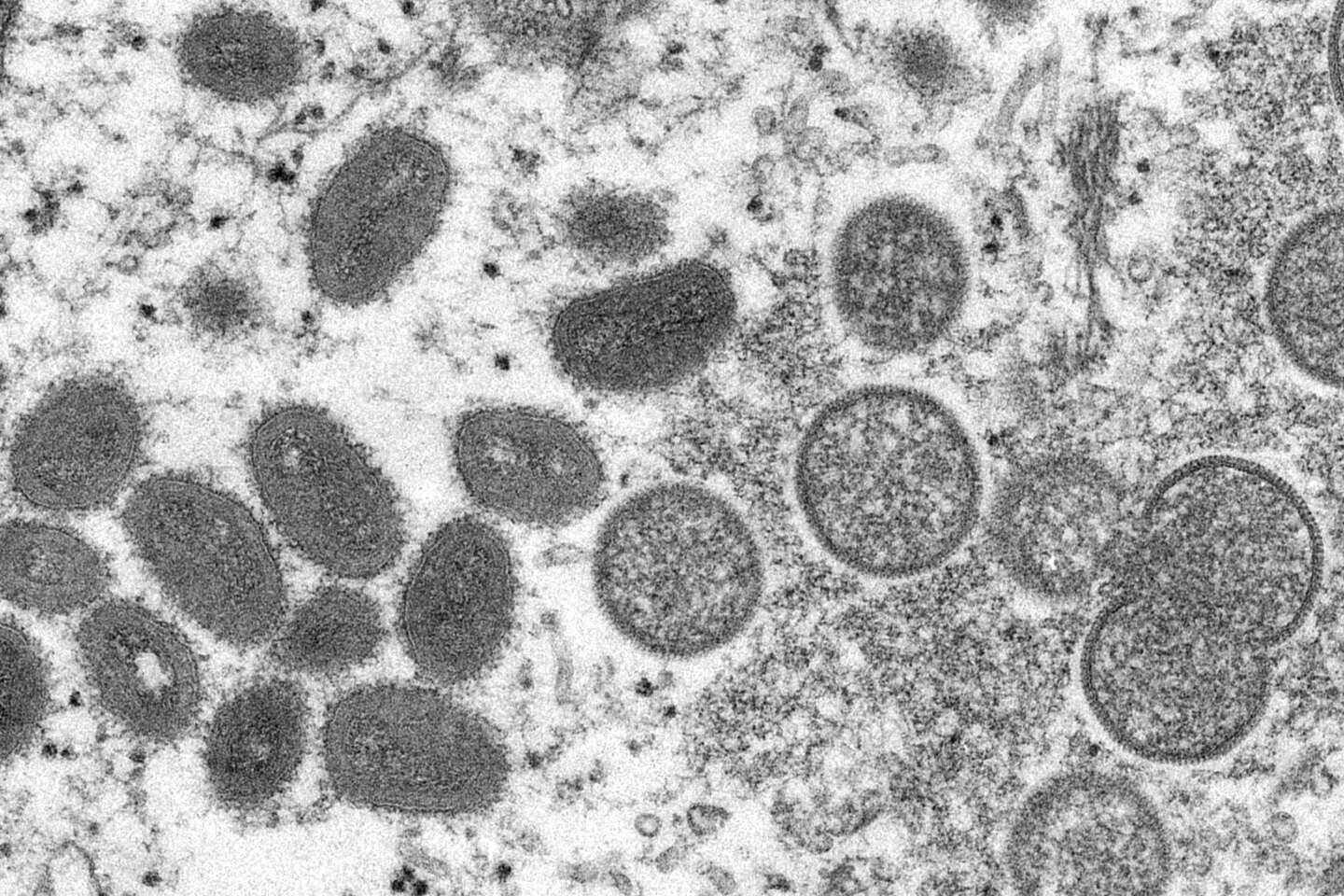 What we know about the “Langya” virus spotted in China