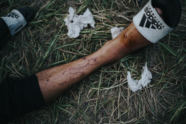 Un migrant montre les blessures faites en essayant d’escalader la clôture pour la Hongrie, à Horgos, en Serbie, le 23 août 2022. 