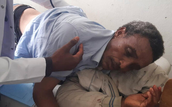 A man injured in aerial bombardments, at the Ayder Referral hospital in Makale, in the Ethiopian region of Tigray, on September 14, 2022.