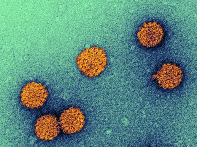 Particules de papillomavirus humain, micrographie électronique à transmission colorée (MET). Les particules (virions) du papillomavirus humain (HPV) sont constituées d’une capside protéique (orange) renfermant l’ADN (acide désoxyribonucléique), le matériel génétique du virus.