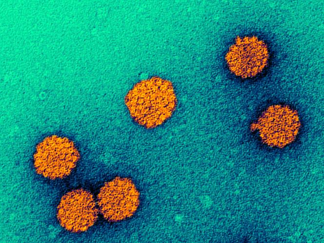 Particules de papillomavirus humain, micrographie électronique à transmission colorée (MET). Les particules (virions) du papillomavirus humain (HPV) sont constituées d’une capside protéique (orange) renfermant l’ADN (acide désoxyribonucléique), le matériel génétique du virus.