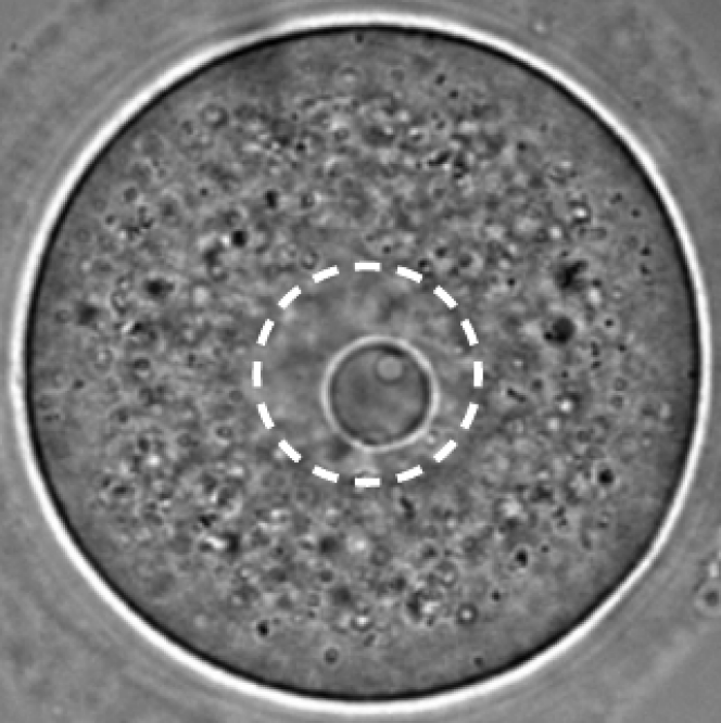 Un ovocyte en cours de développement avec en pointillé son noyau et à l’intérieur un corps nucléaire ou condensat au sein duquel des réactions chimiques de préparation des ARN, notamment, auront lieu. 