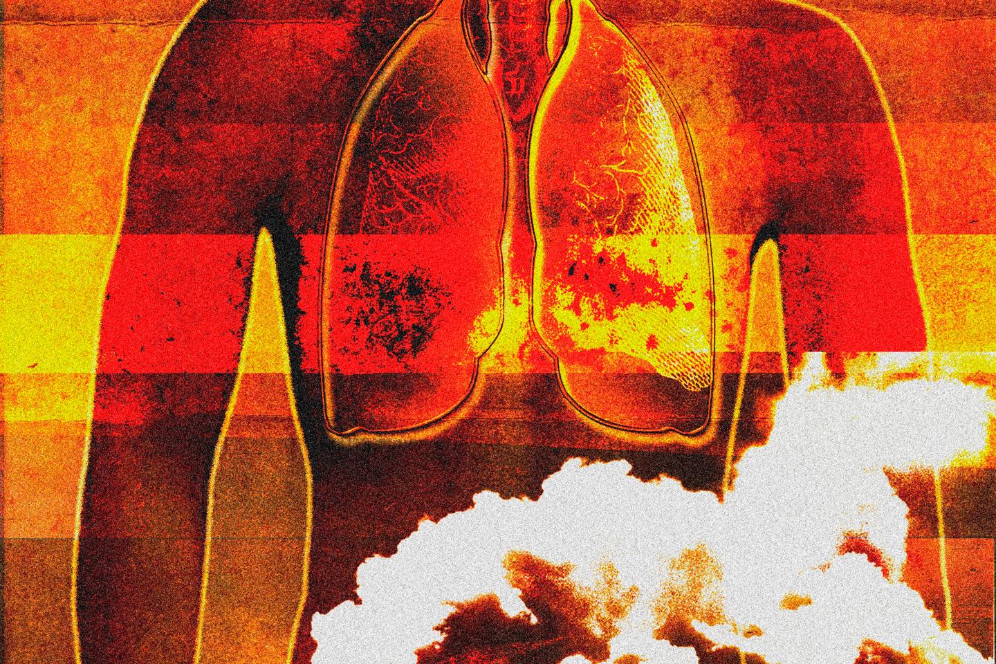 « Les pics de pollution sont associés à des infections respiratoires plus fréquentes »