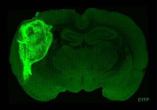 Un organoïde humain transplanté marqué par une protéine fluorescente dans une section du cerveau d’un rat.