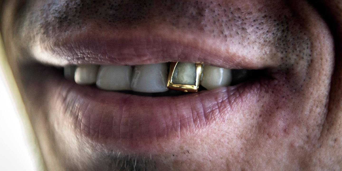 In Paris, jeweler Lavoisier recycles gold teeth