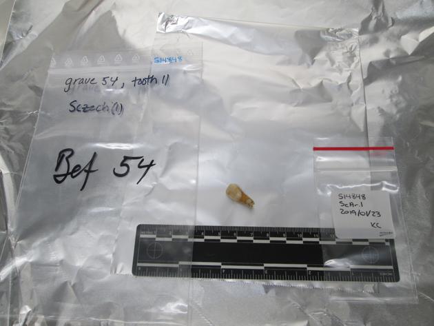 L’une des dents excavées dans le cimetière juif médiéval d’Erfurt (Allemagne), dont l’ADN a été extrait pour l’étude génétique.