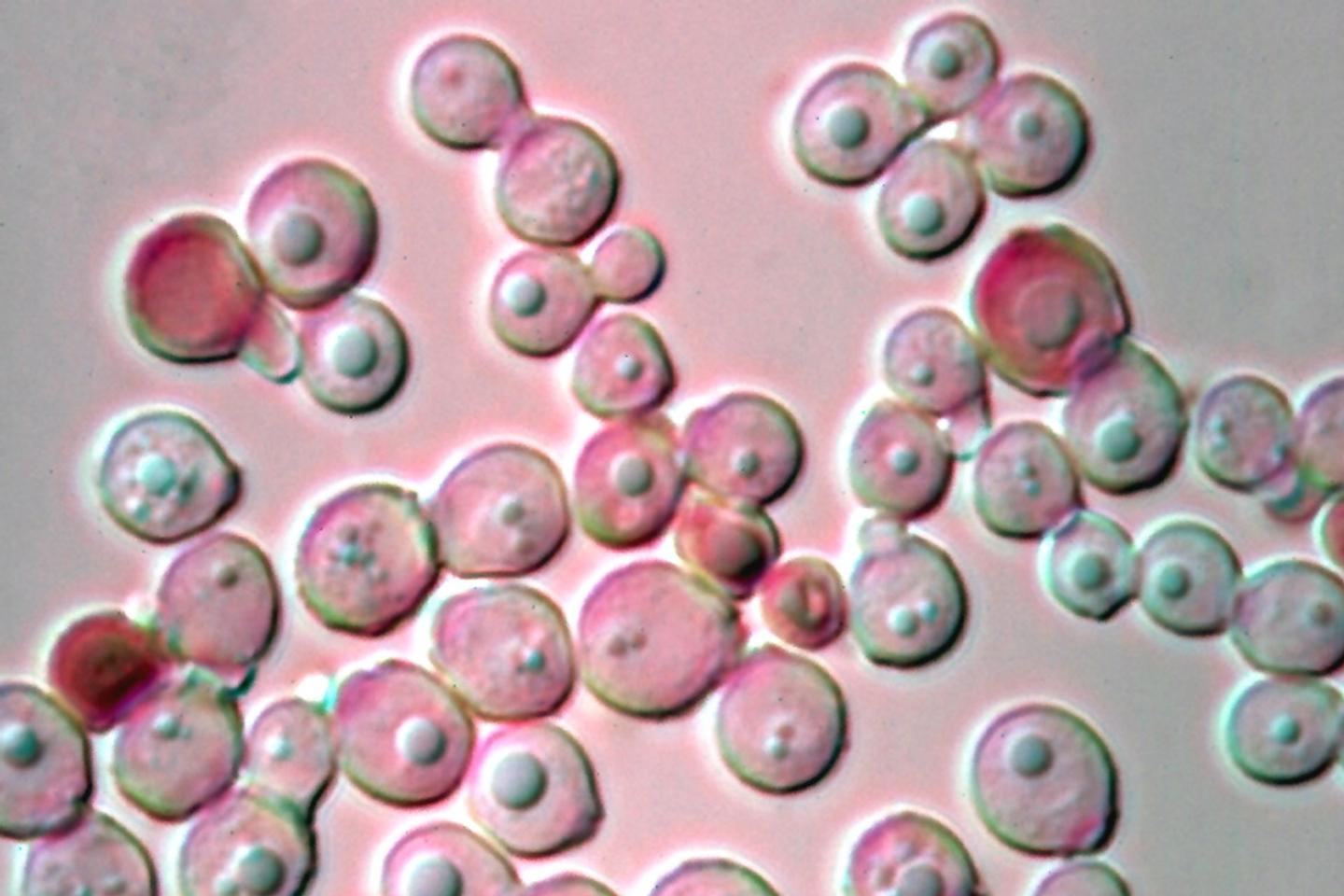 Eliminate a tumor with antifungal treatment Time News