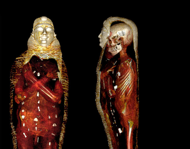 Les images de face et de profil de la momie, « déshabillée » grâce à un appareil de tomographie à rayons X.