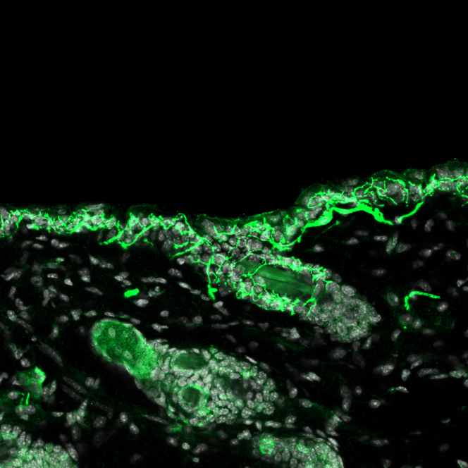 Les terminaisons nerveuses (marquées par immunofluorescence) des neurones de la lignée Mrgprb4, dans la peau du dos de la souris, réagissent à la stimulation optogénétique.