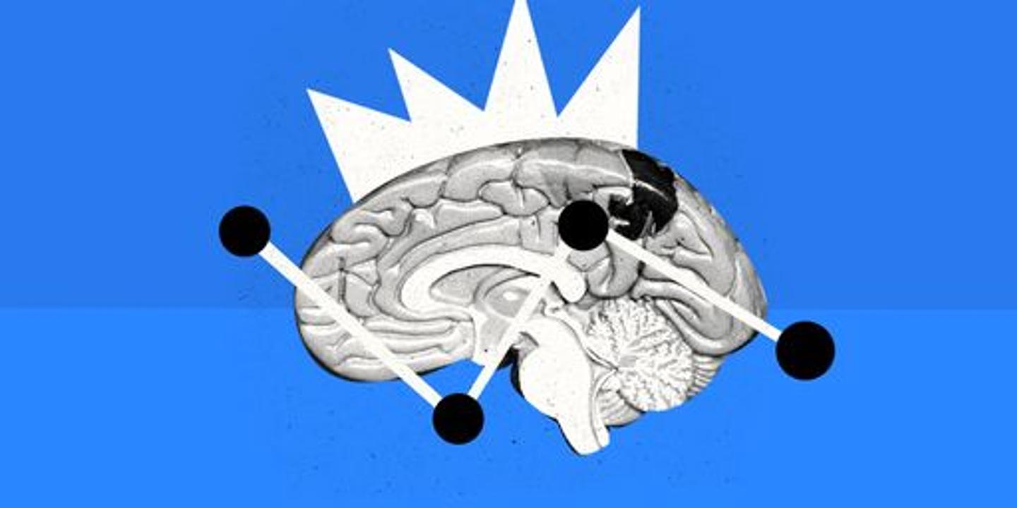 Quiz culture générale : explorez les mystères du cerveau en sept questions