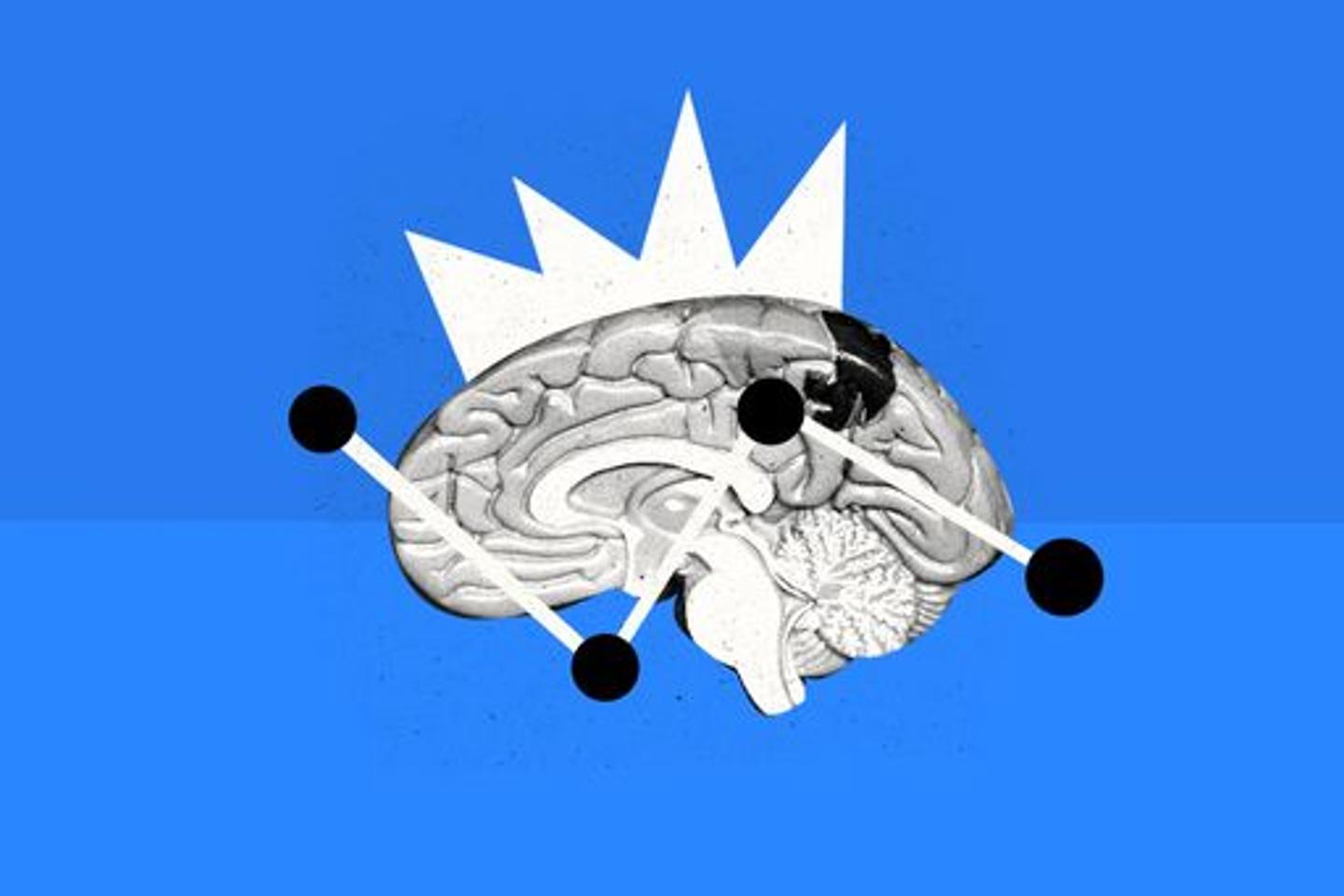 Quiz culture générale : explorez les mystères du cerveau en sept questions