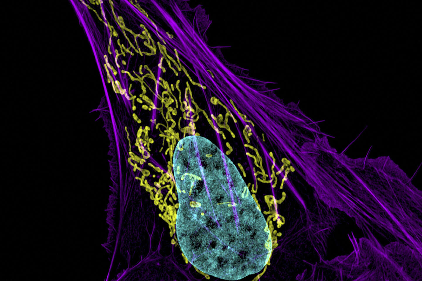 El papel de las mitocondrias en el cáncer se vuelve más claro