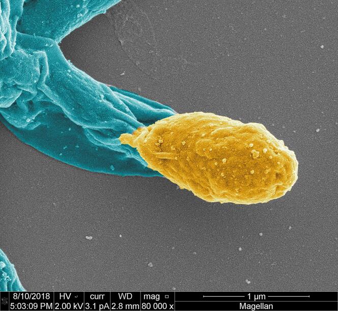 Spore de « Clostridium difficile », au microscope électronique. 