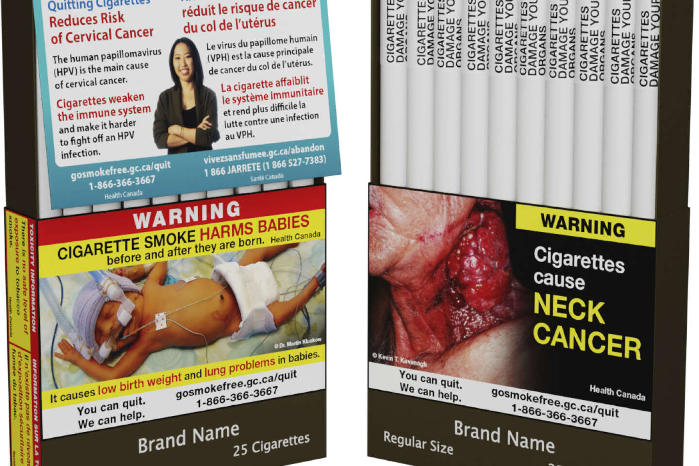 Les filtres des cigarettes sont-ils un instrument de marketing sans aucune  utilité pour la santé ?