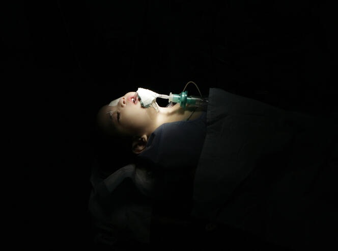 Un paciente joven en una cama de hospital antes de la cirugía para reparar un labio y paladar hendido.  Ciudad de Caloocan, Gran Manila, 12 de abril de 2010.