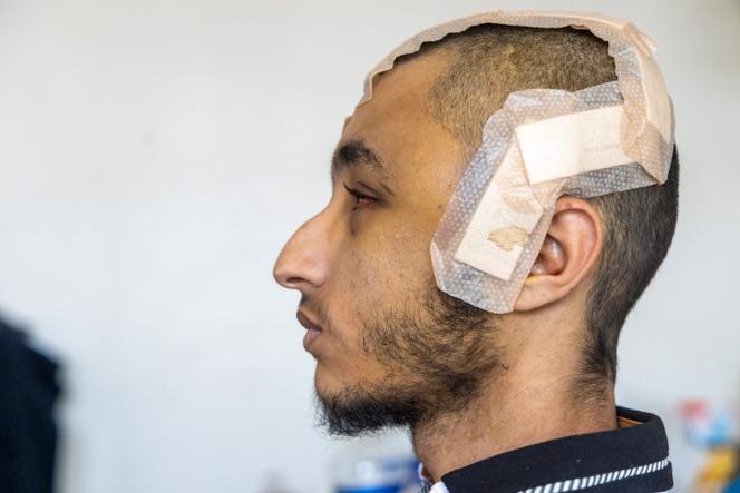 Hedi R. was hit by a rubber ball bullet and beaten by officers during a riot in Marseille, France, on the night of July 1, 2023, even though he was not one of the rioters. Here, pictured on July 9, 2023.