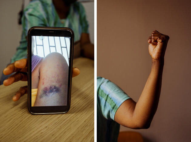 Aissata montre une photo d’une blessure sur son bras, à Marseille, le 5 septembre 2023.