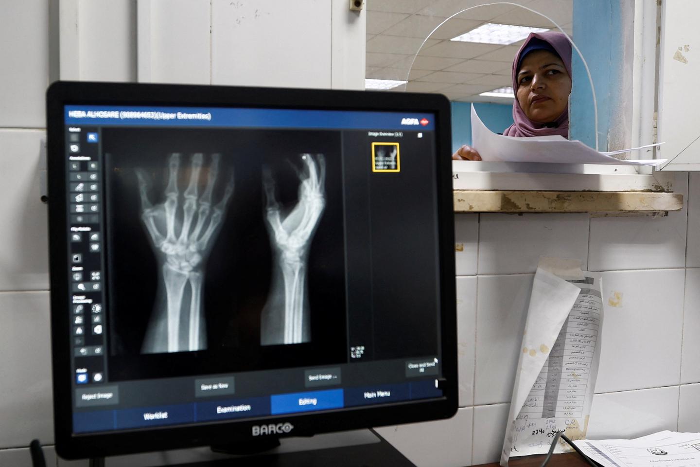 In the Palestinian territories, access to care seriously hampered by Israeli restrictions, according to the World Bank
