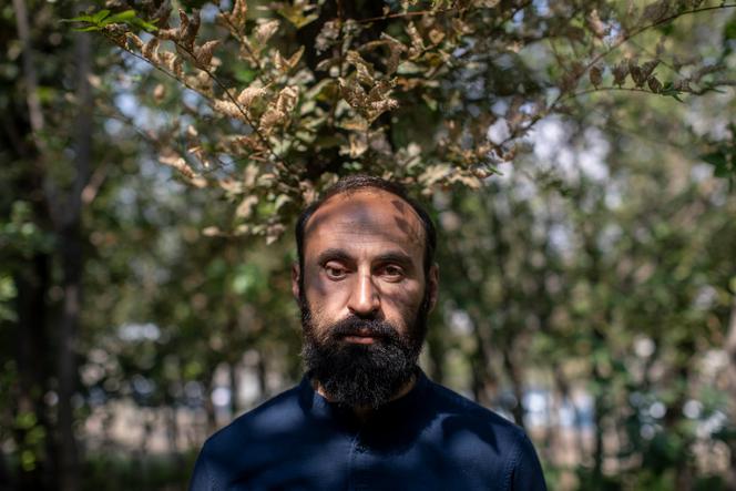 Khatchik Vardanian, a seriously wounded veteran of the 2020 war, at Yerablur military cemetery in Yerevan on September 29, 2023.