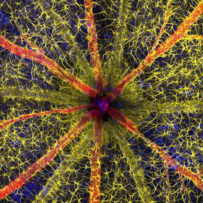 Tête du nerf optique de rongeur montrant des astrocytes (jaune), des protéines contractiles (rouge) et la vascularisation de la rétine (vert).
