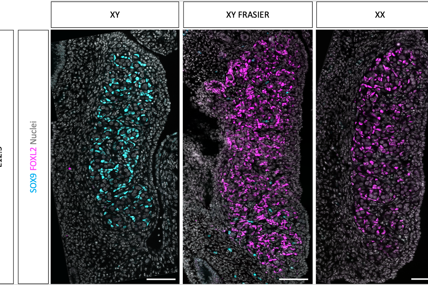 Scientists finally identify protein responsible for initiating ovarian development in embryo