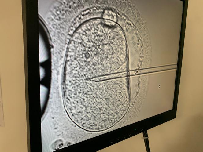 Réalisation d’une fécondation in vitro au laboratoire Drouot de l’hôpital des Diaconesses Croix-Saint-Simon, à Paris, en 2023.