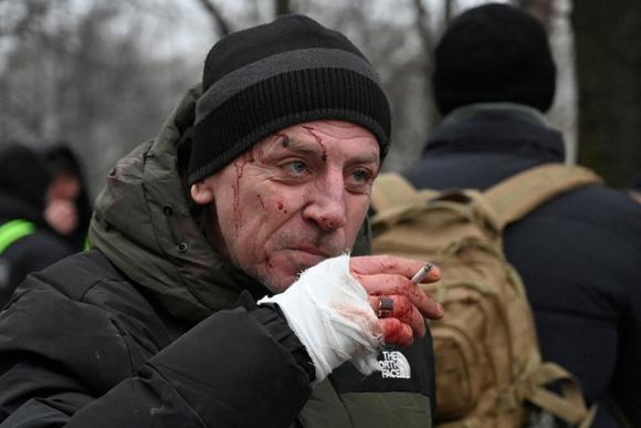 Un habitant blessé dans un tir de missile sur un immeuble résidentiel à Kiev, le 13 décembre 2023.