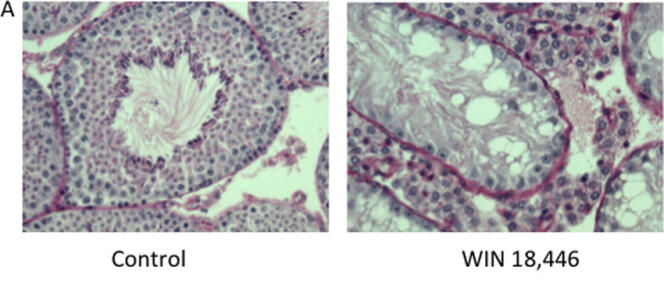 Comparaison des testicules de souris après quatre semaines de traitement par le WIN18446 (à droite) ou sans traitement (à gauche). Dans les premiers, on observe une disparition complète des spermatocytes, les cellules précurseurs des spermatozoïdes ; dans les seconds, la spermatogenèse apparaît normale.