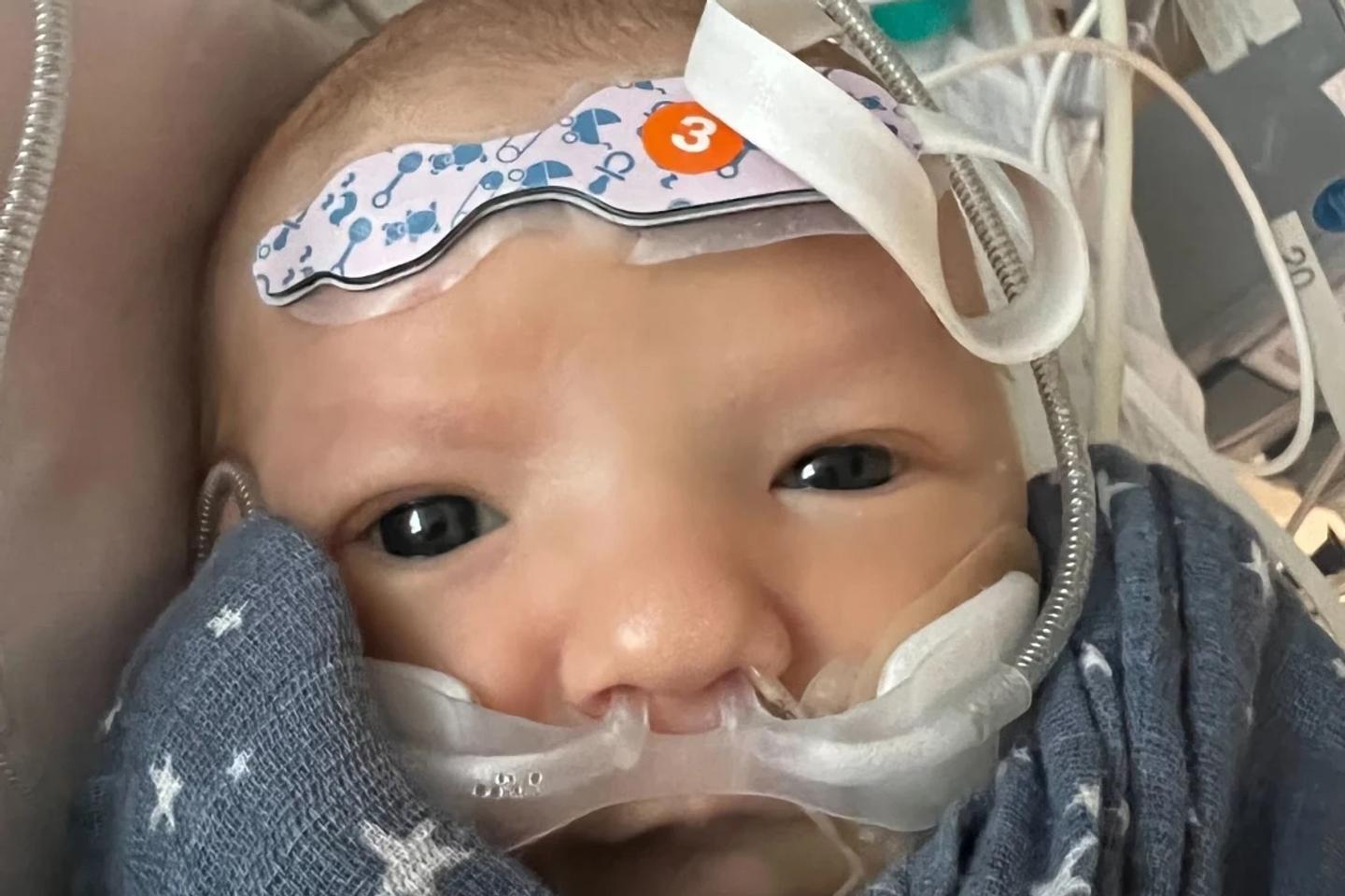 First partial heart transplant in a newborn baby deemed a success