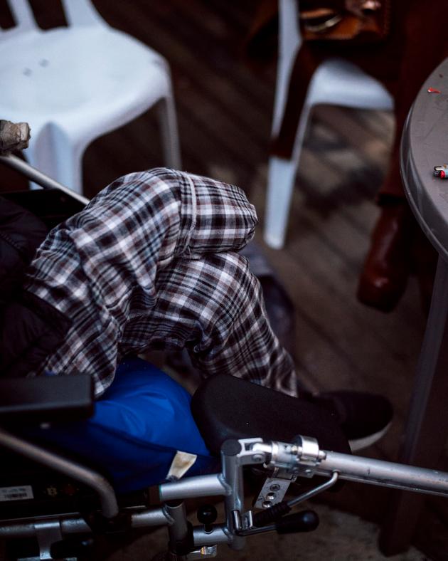 Noam, 20, injured in an explosion in Gaza on November 16, 2023, now a below-the-knee amputee, at Sheba Medical Center in Ramat Gan, Israel, on January 24, 2024.