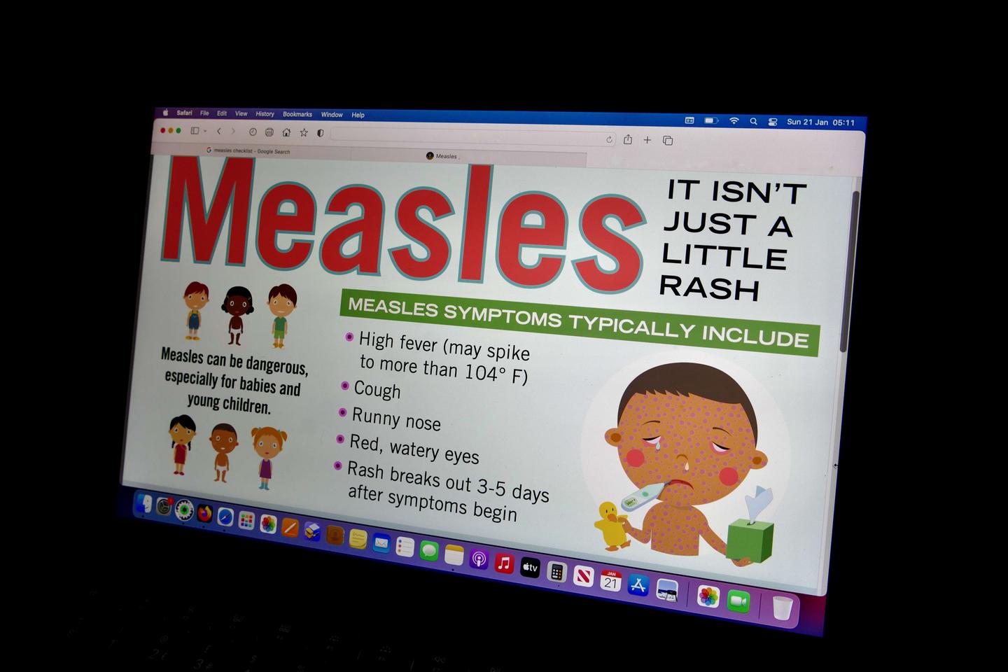 Measles is making a worrying comeback in the UK