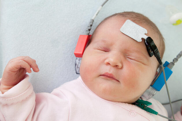 Un test auditif PEA, appelé « potentiel évoqué auditif », est effectué sur un nouveau-né, à l’hôpital Saint-Vincent-de-Paul, à Lille, en avril 2012.