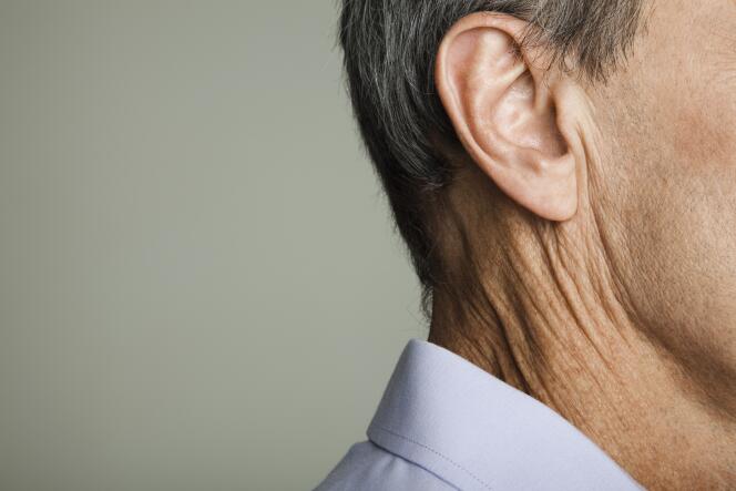 Tinnitus is often linked to acoustic trauma or aging of the ear.