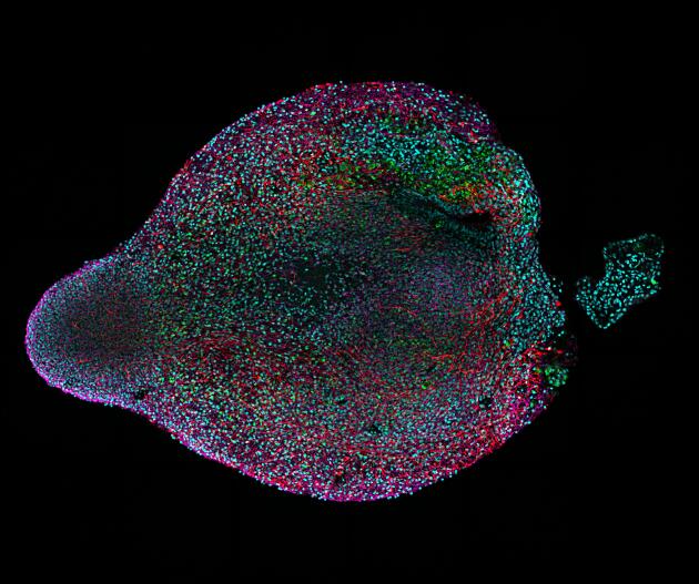 Image en immunofluorescence d’une coupe d’un organoïde représentatif du cortex cérébral humain, âgé de 2 mois).