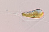 Une algue se dote d’un fertilisateur intracellulaire