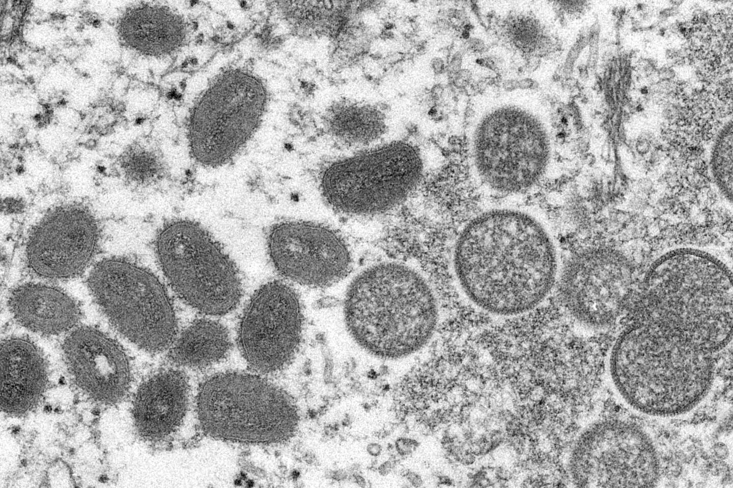 Epidémie de mpox : la RDC va homologuer en urgence deux vaccins et un traitement