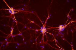 Micrographie en fluorescence montrant des neurones de la moelle épinière de souris.
