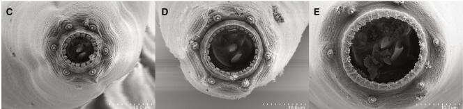 Images au microscope électronique à balayage de bouches de nématodes « A. sudhausi », avec la dent dorsale en haut.