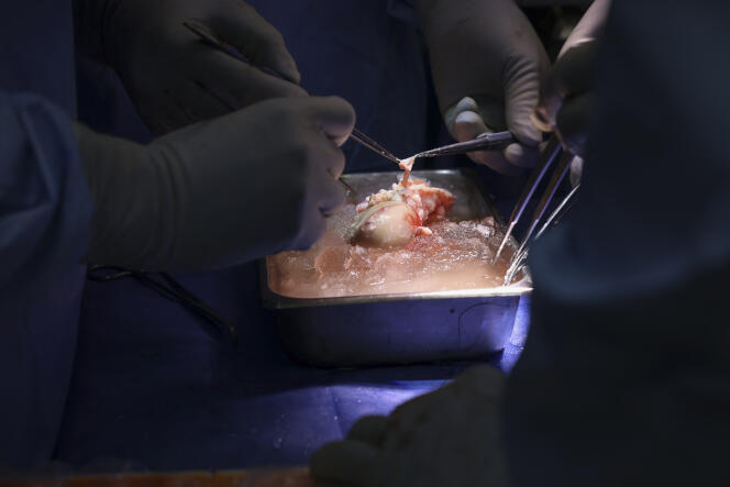Los cirujanos están preparando un riñón de cerdo modificado genéticamente para el primer trasplante de riñón de esta fuente en un ser humano vivo.  Imagen del 16 de marzo de 2024 proporcionada por el Hospital General de Massachusetts en Boston, Estados Unidos.