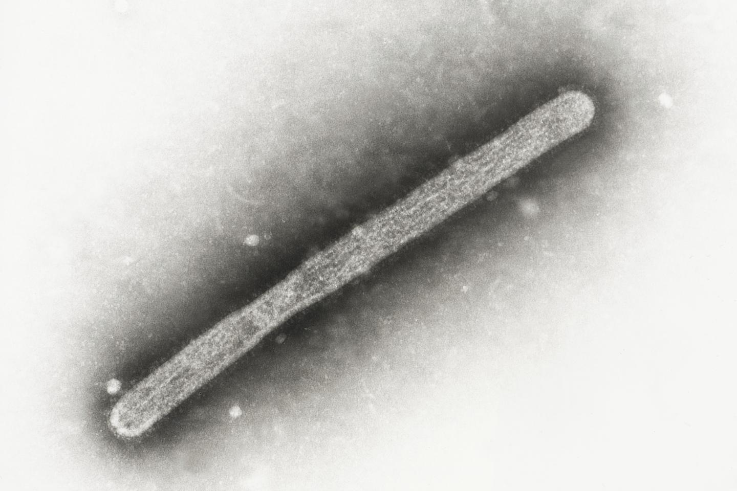 メキシコでは、3歳の娘が鳥インフルエンザH5N1で亡くなります