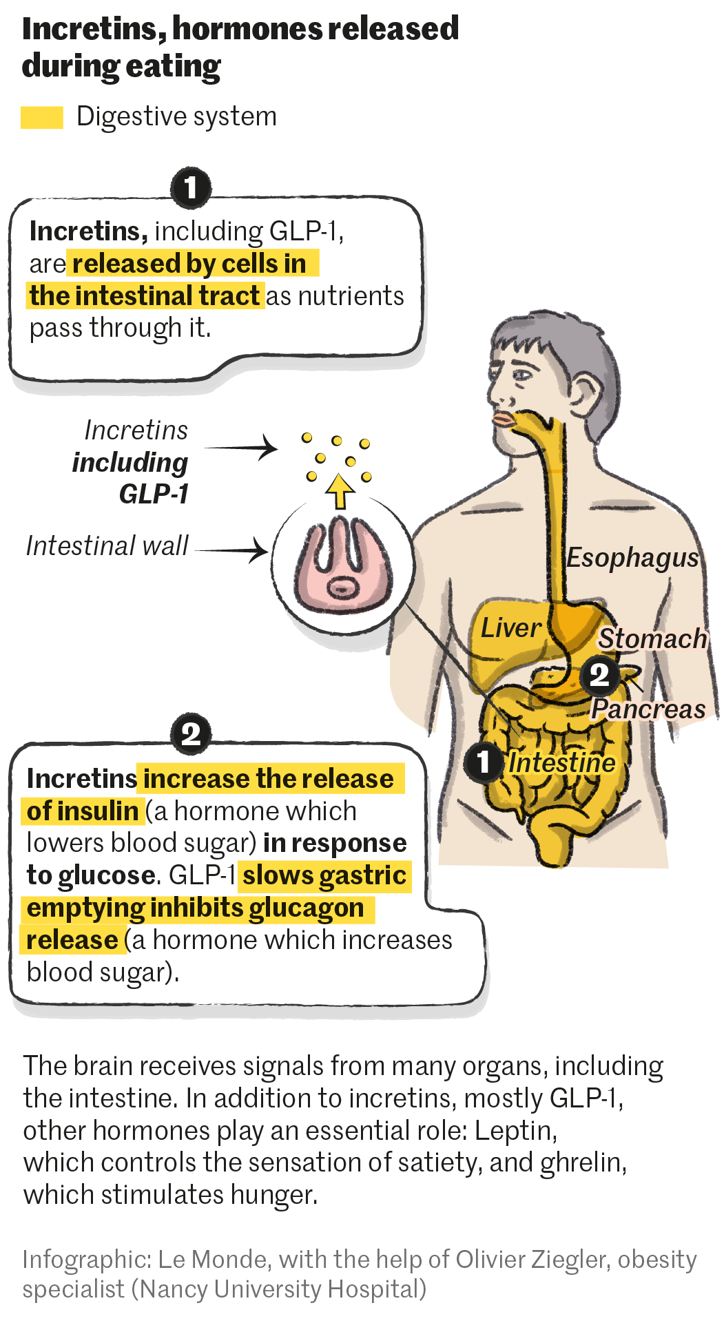 glp-1 intestinal paralysis law firm in michigan How Dangerous Is Gastroparesis?